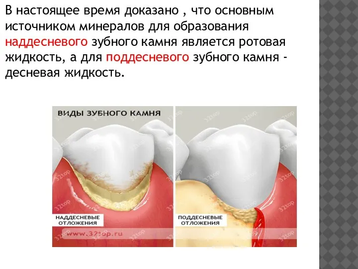 В настоящее время доказано , что основным источником минералов для образования наддесневого