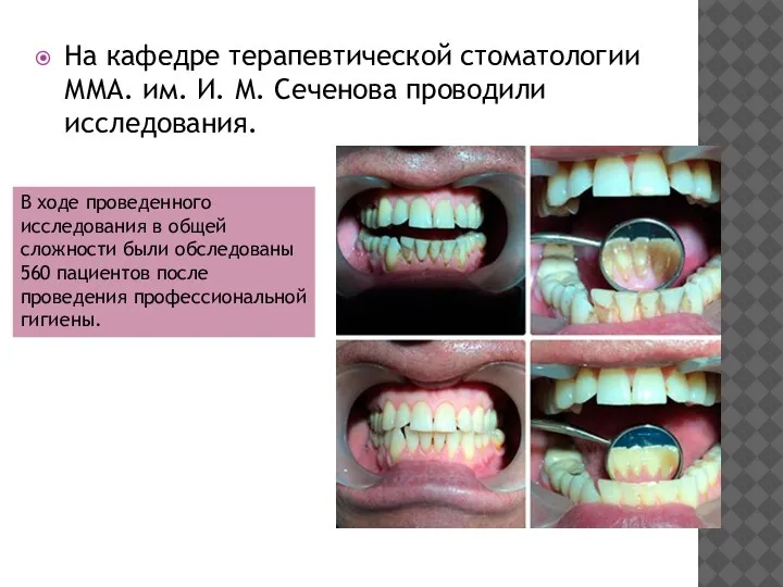 На кафедре терапевтической стоматологии ММА. им. И. М. Сеченова проводили исследования. В