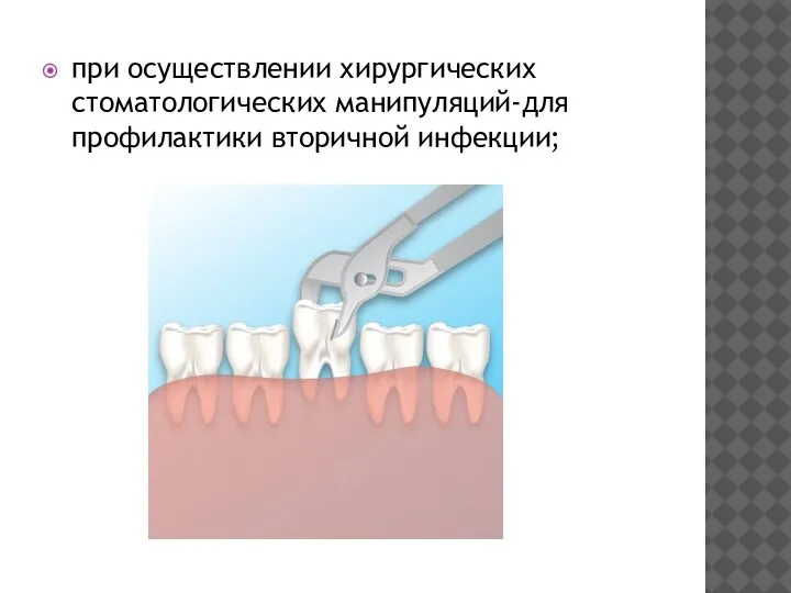 при осуществлении хирургических стоматологических манипуляций-для профилактики вторичной инфекции;