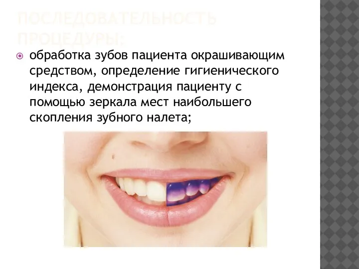 ПОСЛЕДОВАТЕЛЬНОСТЬ ПРОЦЕДУРЫ: обработка зубов пациента окрашивающим средством, определение гигиенического индекса, демонстрация пациенту
