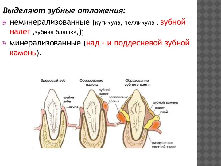 Выделяют зубные отложения: неминерализованные (кутикула, пелликула , зубной налет ,зубная бляшка,); минерализованные