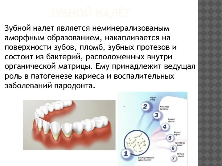 ЗУБНОЙ НАЛЁТ Зубной налет является неминерализованым аморфным образованием, накапливается на поверхности зубов,