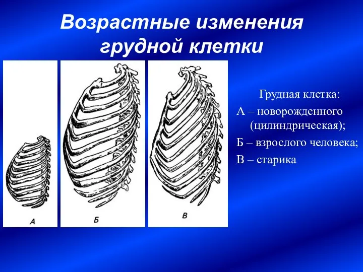 Возрастные изменения грудной клетки Грудная клетка: А – новорожденного (цилиндрическая); Б –