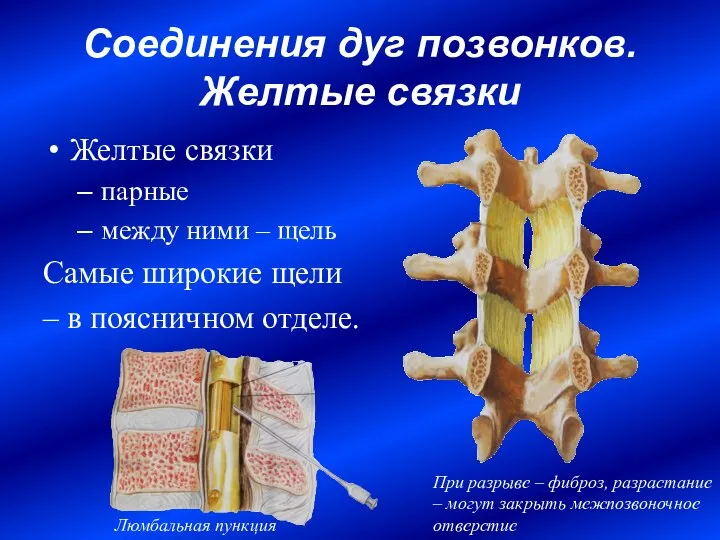 Соединения дуг позвонков. Желтые связки Желтые связки парные между ними – щель