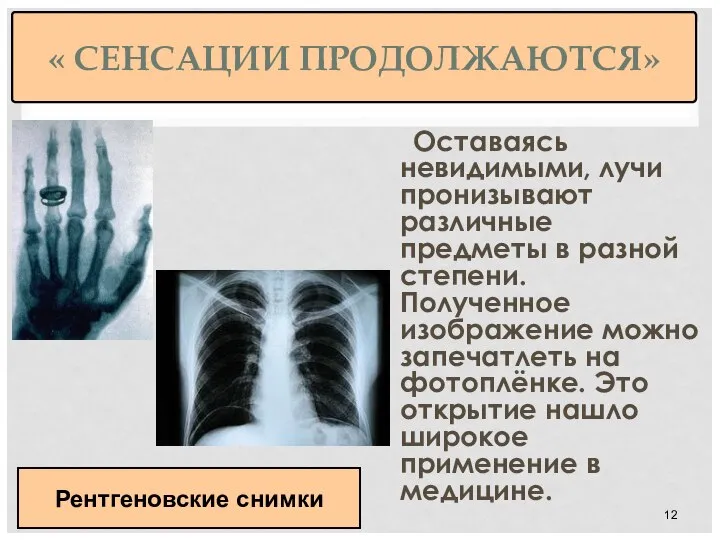 « СЕНСАЦИИ ПРОДОЛЖАЮТСЯ» Оставаясь невидимыми, лучи пронизывают различные предметы в разной степени.