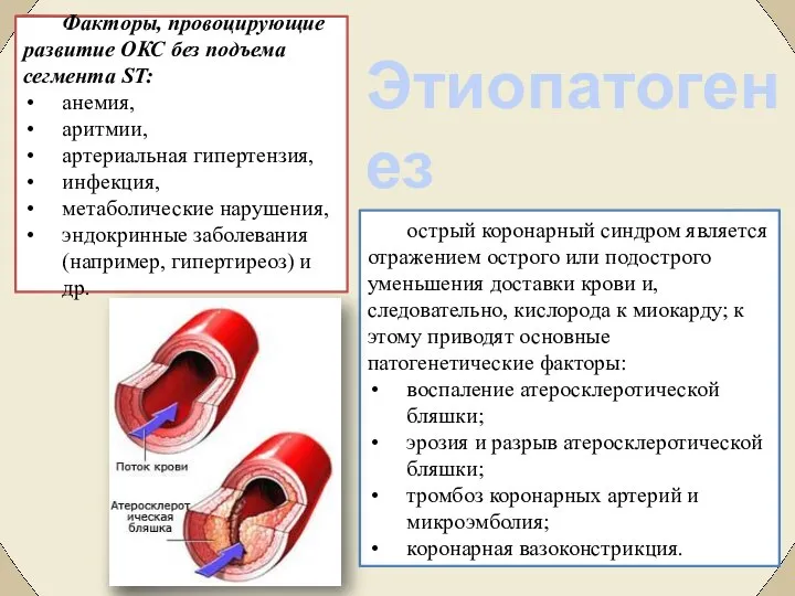 Факторы, провоцирующие развитие ОКС без подъема сегмента ST: анемия, аритмии, артериальная гипертензия,