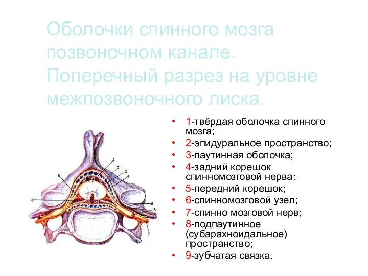 Оболочки спинного мозга позвоночном канале. Поперечный разрез на уровне межпозвоночного лиска. 1-твёрдая