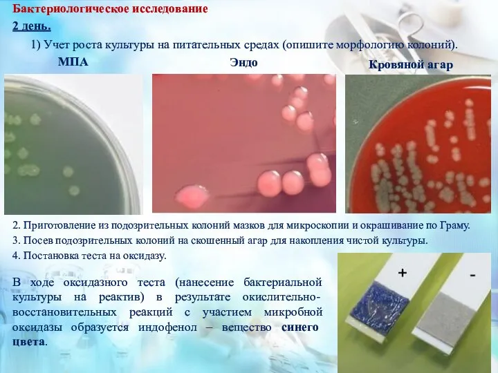 1) Учет роста культуры на питательных средах (опишите морфологию колоний). Бактериологическое исследование