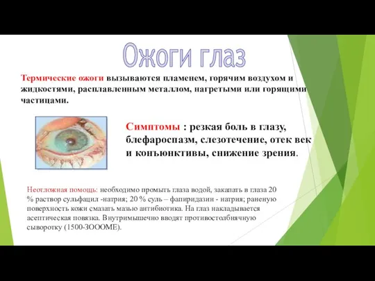 Ожоги глаз Симптомы : резкая боль в глазу, блефароспазм, слезотечение, отек век