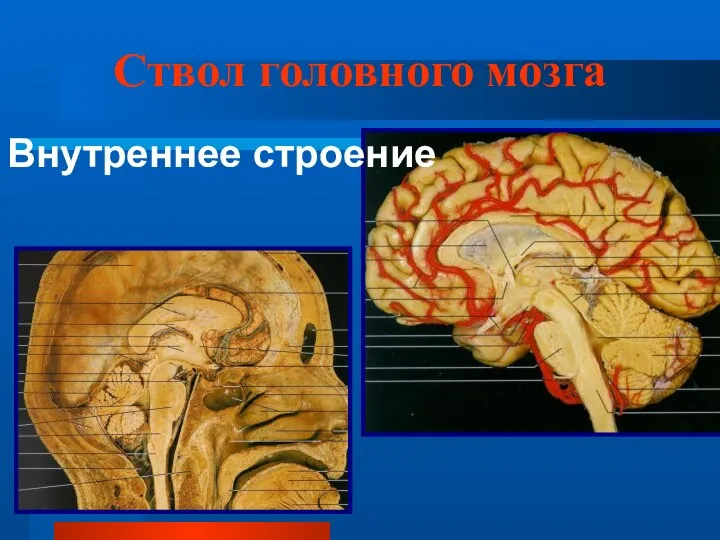 Ствол головного мозга Внутреннее строение