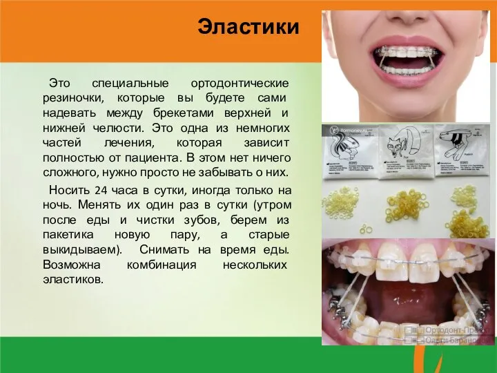 Эластики Это специальные ортодонтические резиночки, которые вы будете сами надевать между брекетами