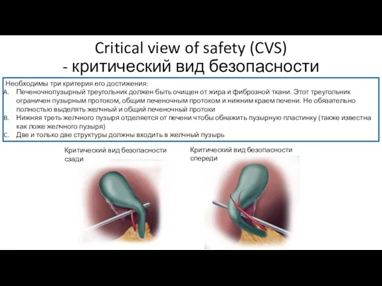 Critical view of safety (CVS) - критический вид безопасности Необходимы три критерия