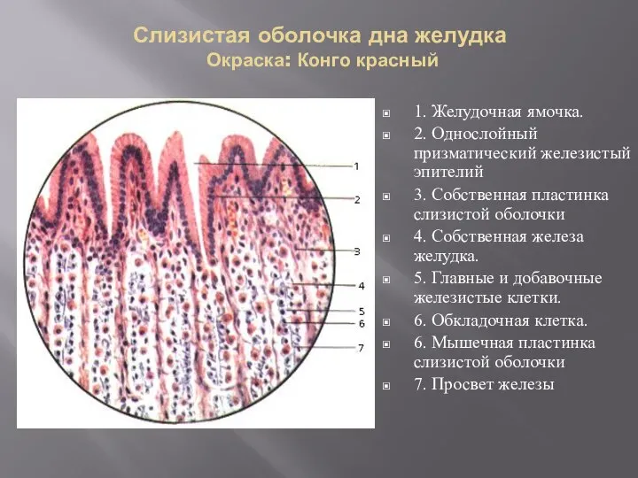 Слизистая оболочка дна желудка Окраска: Конго красный 1. Желудочная ямочка. 2. Однослойный