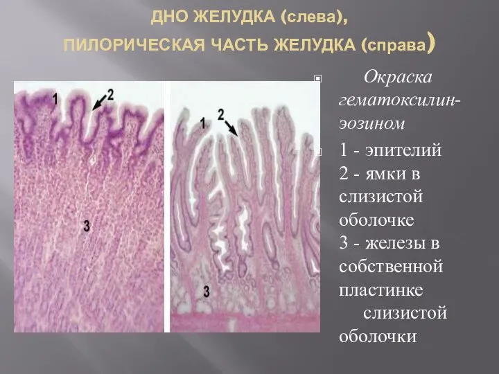 ДНО ЖЕЛУДКА (слева), ПИЛОРИЧЕСКАЯ ЧАСТЬ ЖЕЛУДКА (справа) Окраска гематоксилин-эозином 1 - эпителий