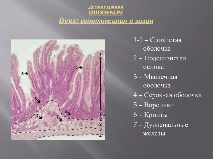 Демонстрация DUODENUM Dyes: гематоксилин и эозин 1-1 – Слизистая оболочка 2 –