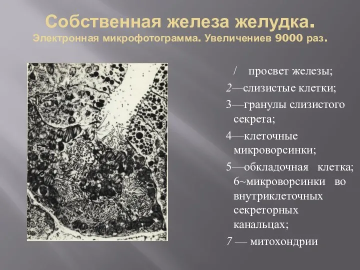 Собственная железа желудка. Электронная микрофотограмма. Увеличениев 9000 раз. / просвет железы; 2—слизистые