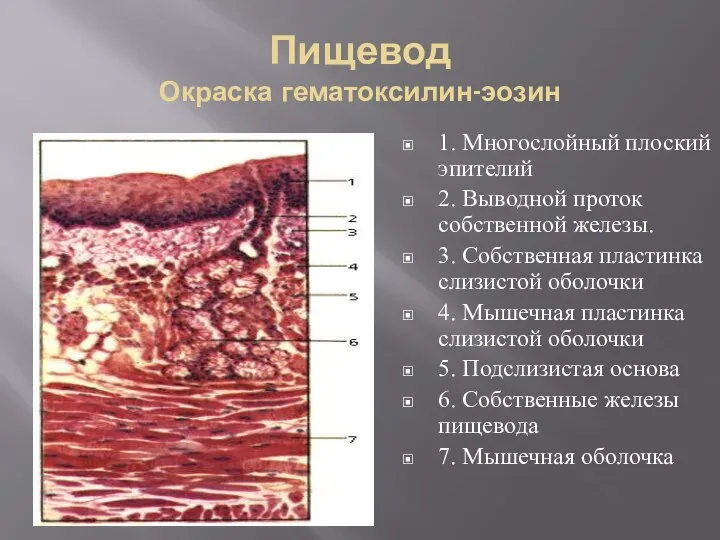 Пищевод Окраска гематоксилин-эозин 1. Многослойный плоский эпителий 2. Выводной проток собственной железы.