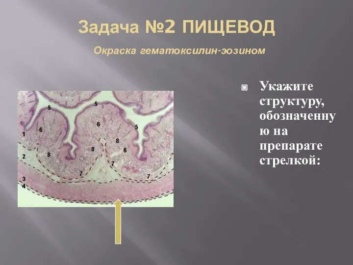 Задача №2 ПИЩЕВОД Окраска гематоксилин-эозином Укажите структуру, обозначенную на препарате стрелкой: