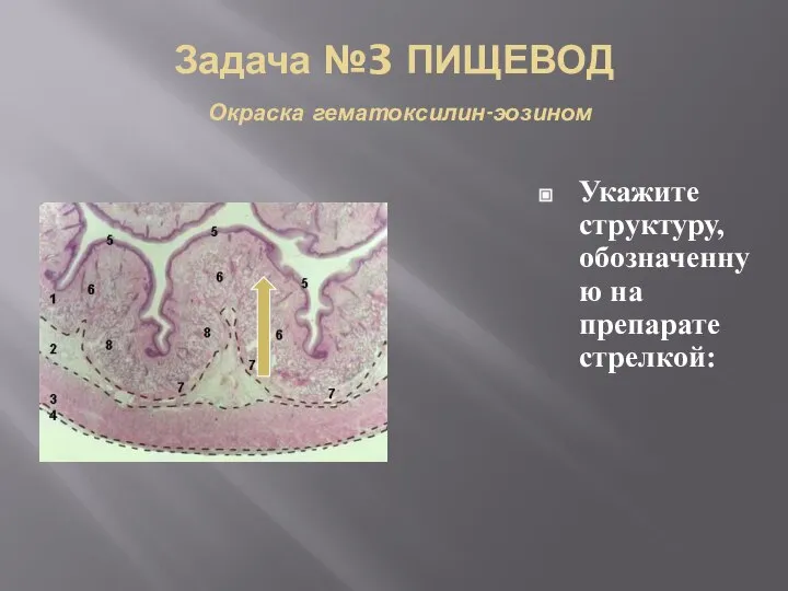 Задача №3 ПИЩЕВОД Окраска гематоксилин-эозином Укажите структуру, обозначенную на препарате стрелкой: