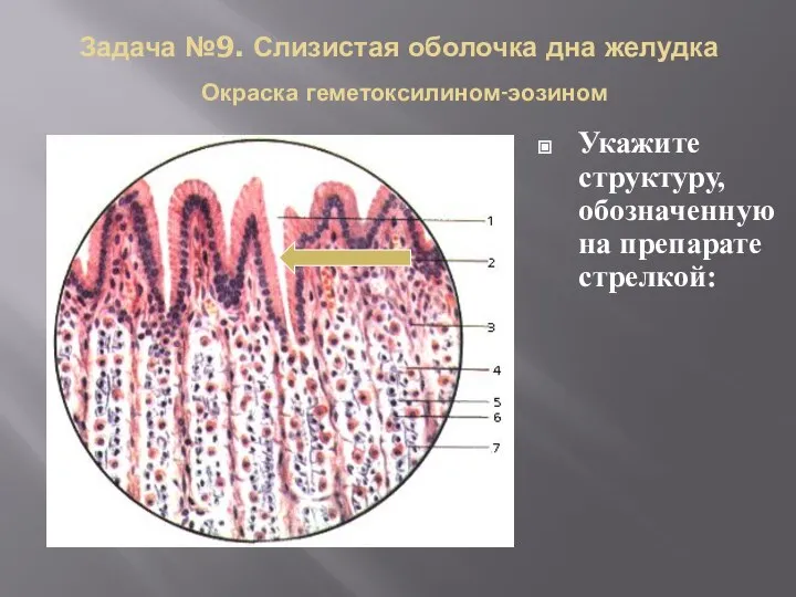 Задача №9. Слизистая оболочка дна желудка Окраска геметоксилином-эозином Укажите структуру, обозначенную на препарате стрелкой: