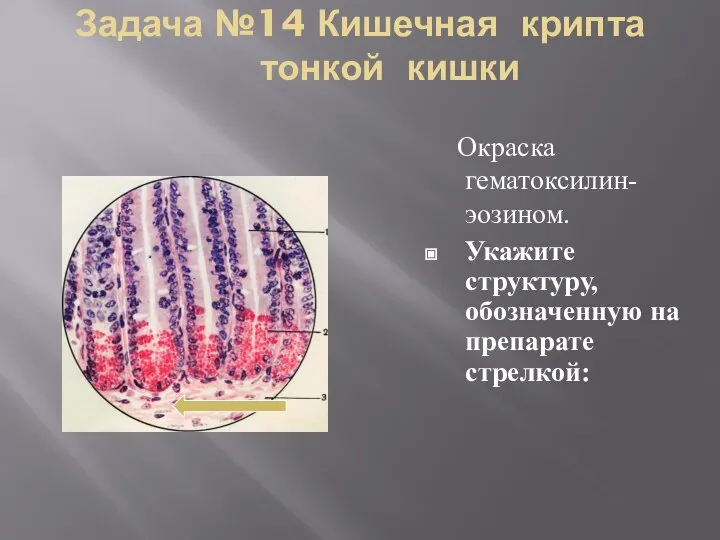 Задача №14 Кишечная крипта тонкой кишки Окраска гематоксилин-эозином. Укажите структуру, обозначенную на препарате стрелкой: