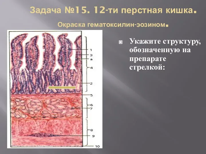 Задача №15. 12-ти перстная кишка. Окраска гематоксилин-эозином. Укажите структуру, обозначенную на препарате стрелкой: