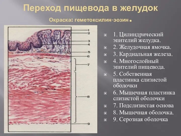 Переход пищевода в желудок Окраска: геметоксилин-эозин. 1. Цилиндрический эпителий желудка. 2. Желудочная