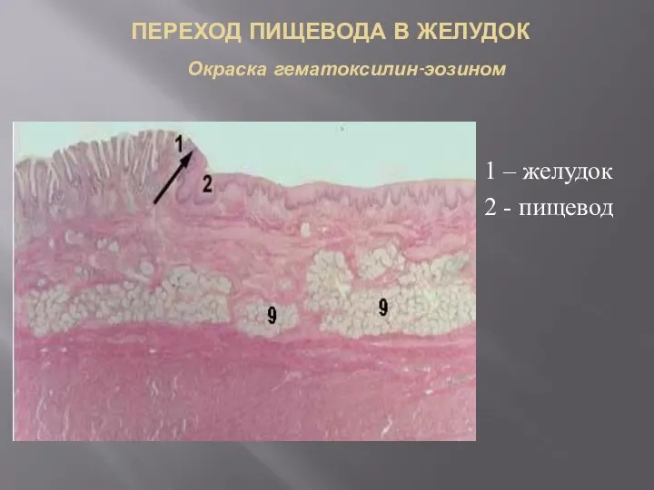 ПЕРЕХОД ПИЩЕВОДА В ЖЕЛУДОК Окраска гематоксилин-эозином 1 – желудок 2 - пищевод