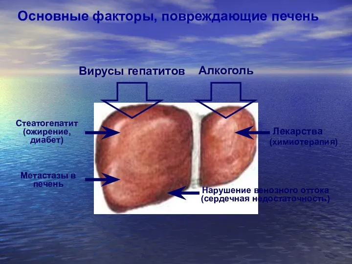 Стеатогепатит (ожирение, диабет) Нарушение венозного оттока (сердечная недостаточность) Лекарства Метастазы в печень
