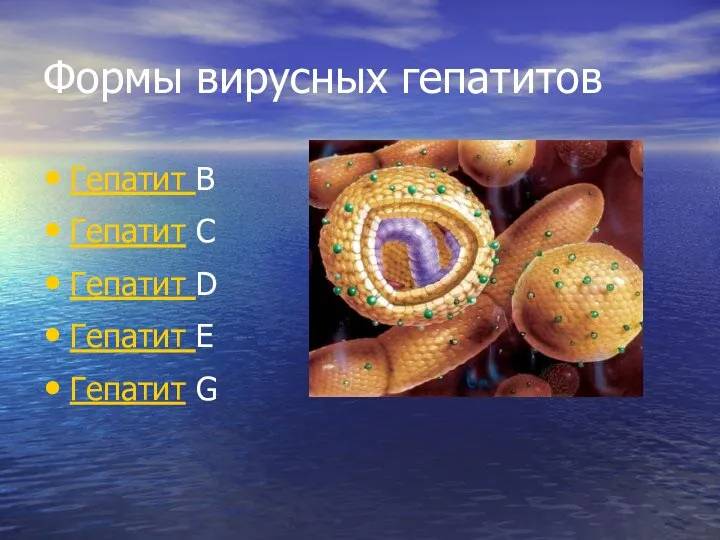 Формы вирусных гепатитов Гепатит В Гепатит С Гепатит D Гепатит Е Гепатит G