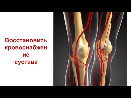 Восстановить кровоснабжение сустава