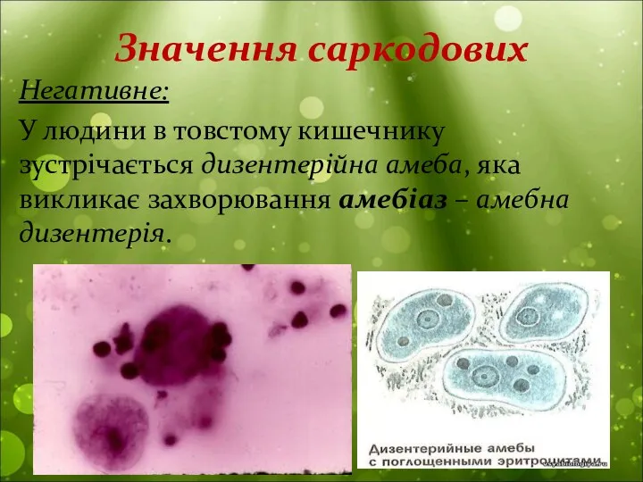 Значення саркодових Негативне: У людини в товстому кишечнику зустрічається дизентерійна амеба, яка