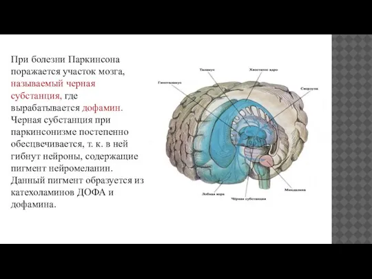 При болезни Паркинсона поражается участок мозга, называемый черная субстанция, где вырабатывается дофамин.