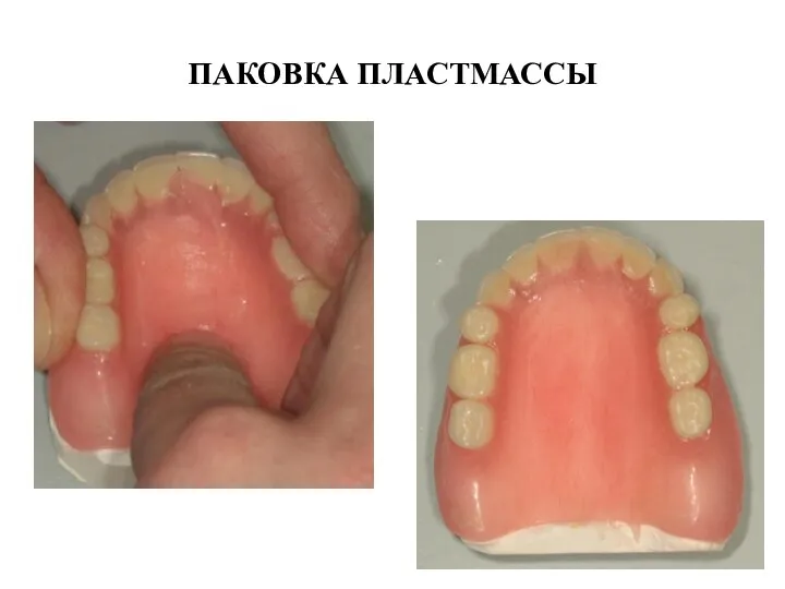 ПАКОВКА ПЛАСТМАССЫ