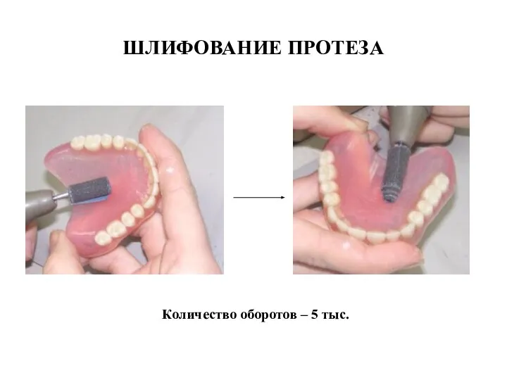 Количество оборотов – 5 тыс. ШЛИФОВАНИЕ ПРОТЕЗА