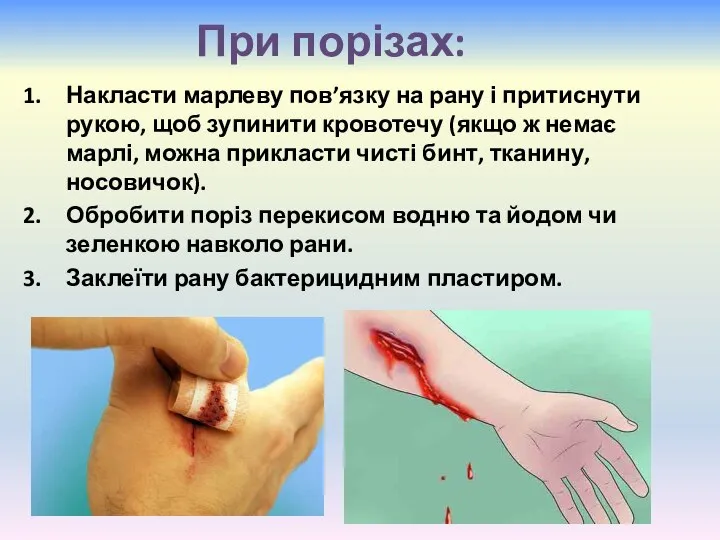 При порізах: Накласти марлеву пов’язку на рану і притиснути рукою, щоб зупинити