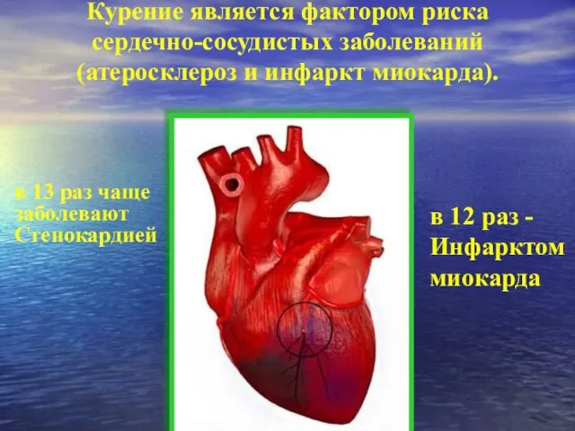 Курение является фактором риска сердечно-сосудистых заболеваний (атеросклероз и инфаркт миокарда). в 13