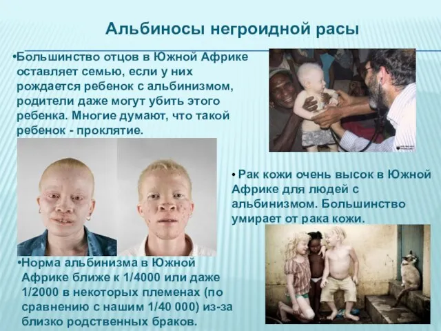 • Рак кожи очень высок в Южной Африке для людей с альбинизмом.
