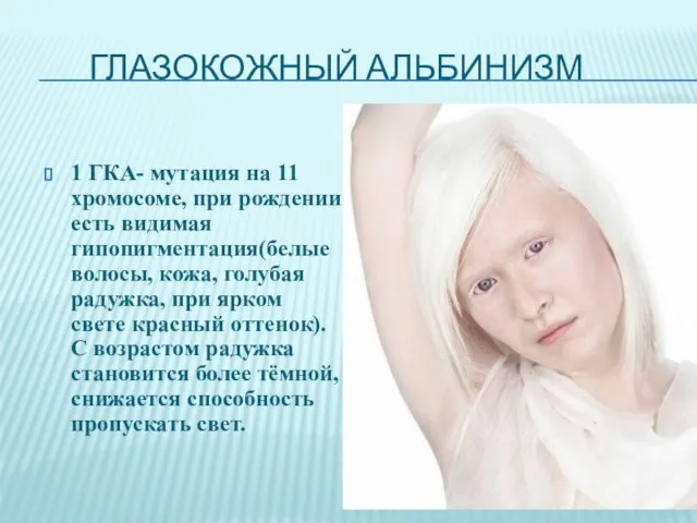 Глазокожный Альбинизм 1 ГКА- мутация на 11 хромосоме, при рождении есть видимая