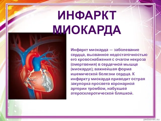 Инфаркт миокарда — заболевание сердца, вызванное недостаточностью его кровоснабжения с очагом некроза