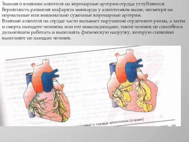 Знания о влиянии алкоголя на коронарные артерии сердца углубляются. Вероятность развития инфаркта