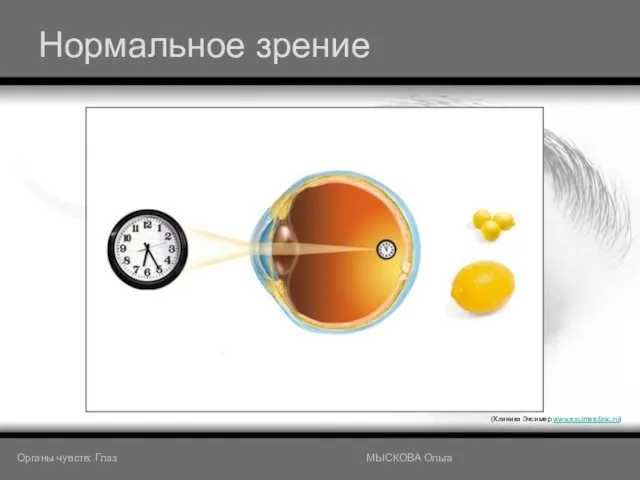 Нормальное зрение (Клиника Эксимер www.excimerclinic.ru) Органы чувств: Глаз МЫСКОВА Ольга