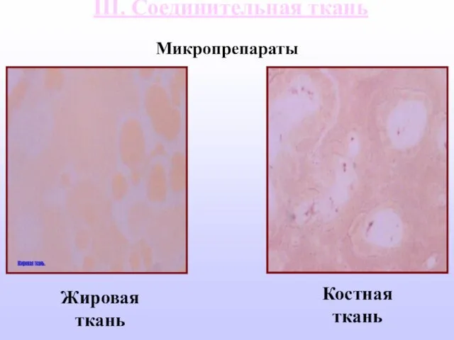 III. Соединительная ткань Жировая ткань Костная ткань Микропрепараты