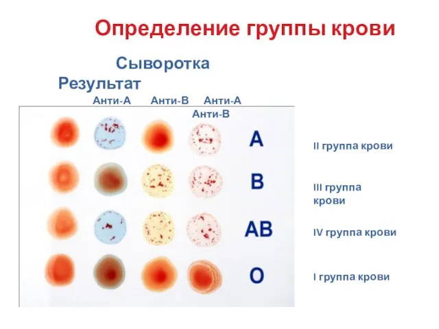 II группа крови III группа крови IV группа крови I группа крови