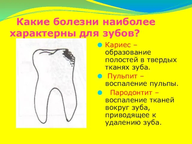 Какие болезни наиболее характерны для зубов? Кариес – образование полостей в твердых