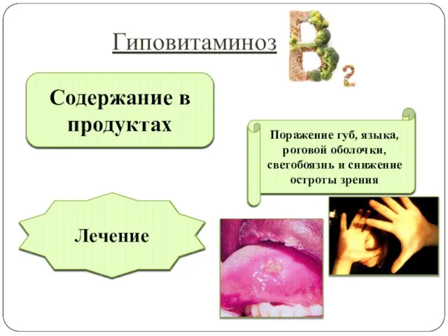 Проявления Молоко, сыр, яичный белок, говядина, печень и потроха животных Уменьшение симптомов