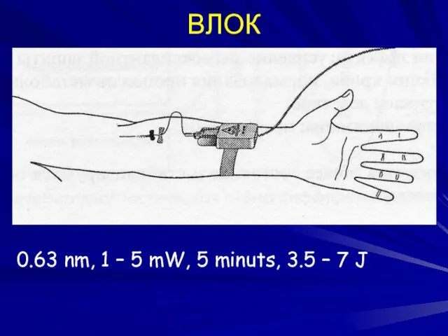 ВЛОК 0.63 nm, 1 – 5 mW, 5 minuts, 3.5 – 7 J