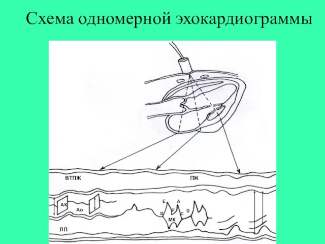 Схема одномерной эхокардиограммы АК Ао ЛП ПЖ ВТПЖ МК D D C A F E