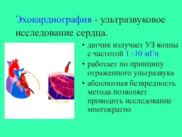 Эхокардиография - ультразвуковое исследование сердца. датчик излучает УЗ волны с частотой 1