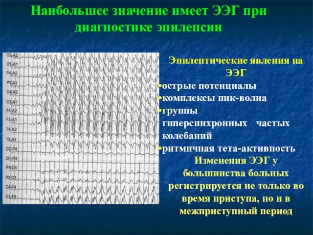 Наибольшее значение имеет ЭЭГ при диагностике эпилепсии Эпилептические явления на ЭЭГ острые